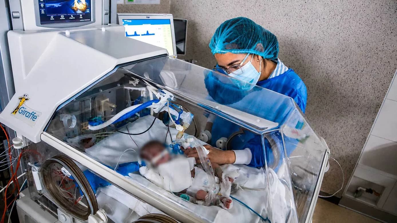 Bebé prematuro supera compleja intervención al corazón en Perú