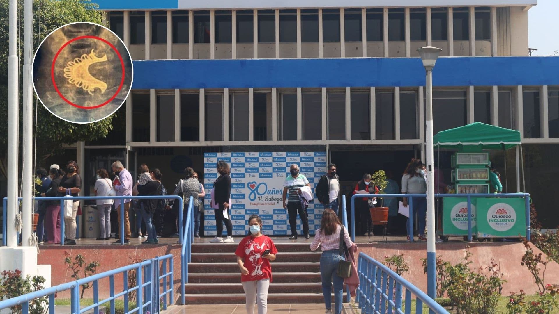 Salvan a adulto mayor que se tragó su dentadura postiza