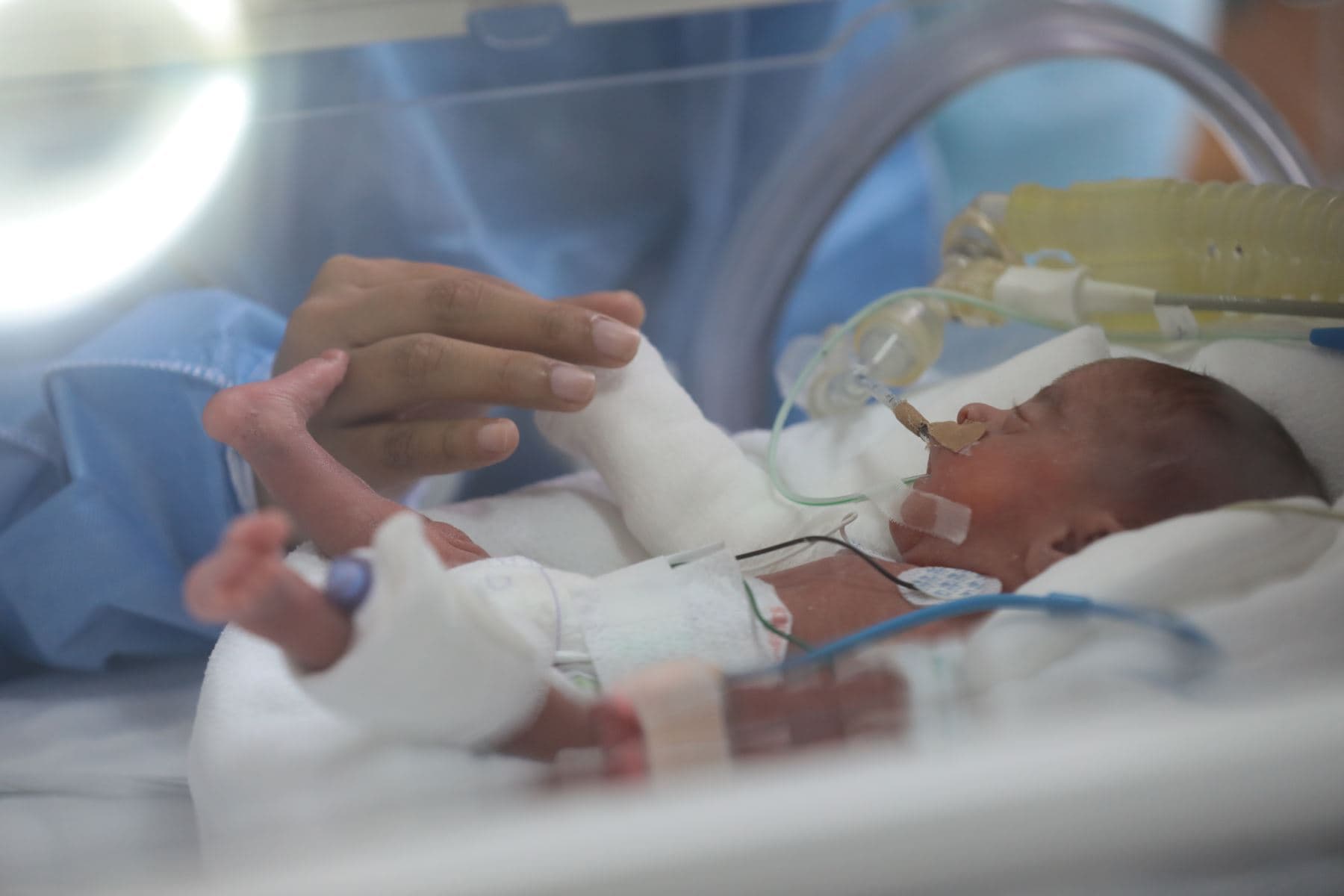 Menores en Perú de un año están expuestos al Virus Sincitial Respiratorio (VSR)