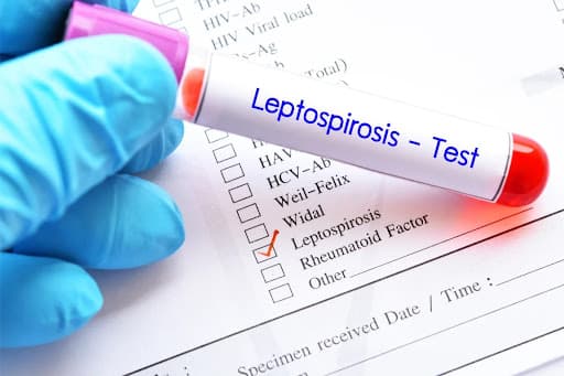 Minsa reporta la muerte de 3 personas por leptospirosis en el Perú