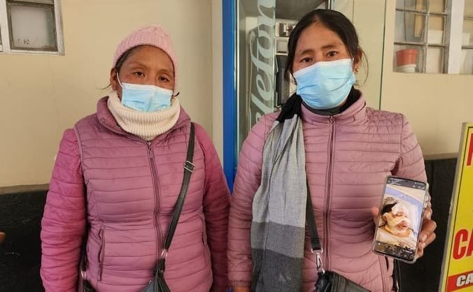 Derivan a Arequipa a mujer que fue quemada por pareja