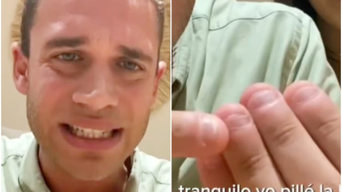 Youtuber español casi muere por comerse las uñas