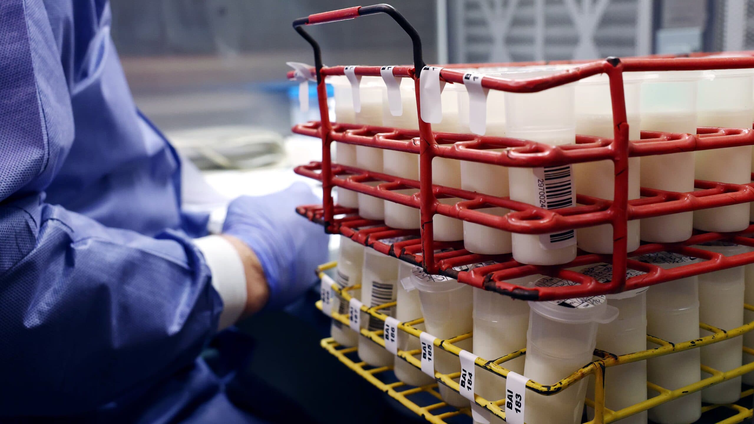 EE.UU. reporta el primer caso grave de gripe aviar en humano