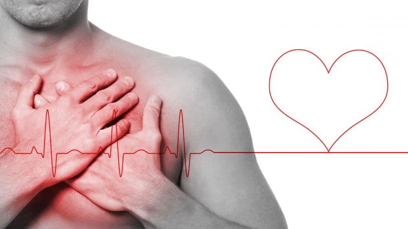 Nuevo problema cardiovascular relacionado a la COVID-19