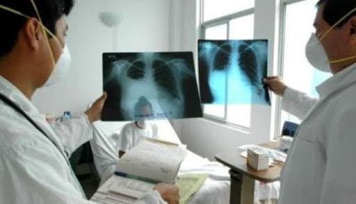 Cada año se detectan cerca de 800 casos de tuberculosis