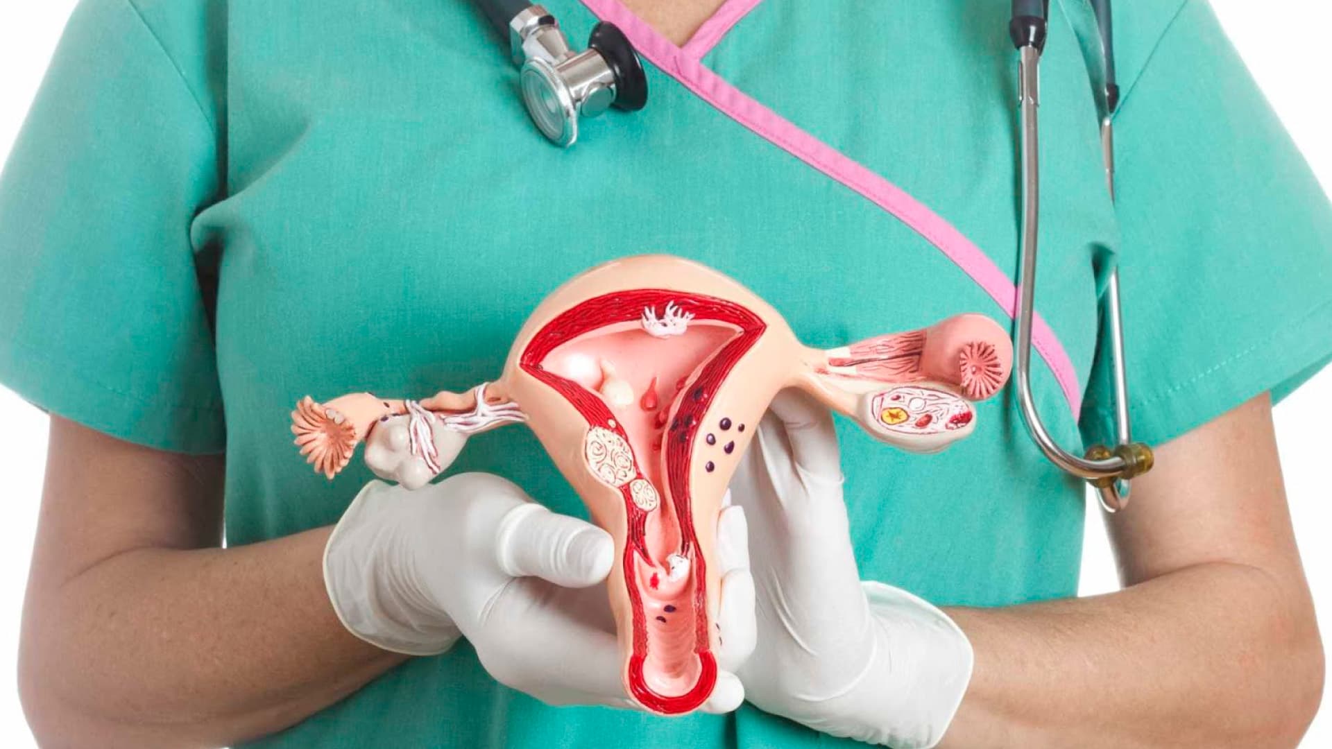 Cáncer de cuello uterino cobra siete vidas diarias en Perú