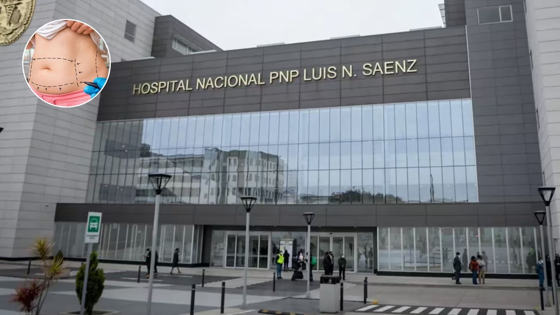 Mujer muere tras someterse a liposucción en Hospital Nacional PNP