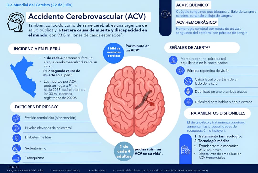 ACV o derrame cerebral: estas son las señales que debes reconocer