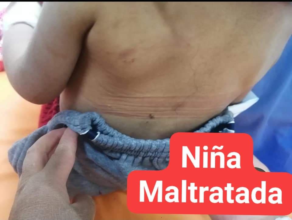 La Joya: Agreden cruelmente a menor de 3 años